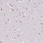 Immunohistochemical staining of human cerebral cortex shows moderate cytoplasmic positivity in neurons.