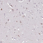Immunohistochemical staining of human cerebral cortex shows moderate cytoplasmic positivity in neurons.