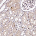 Immunohistochemical staining of human kidney shows moderate cytoplasmic positivity in cells in tubules.