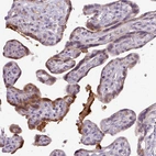 Immunohistochemical staining of human placenta shows moderate cytoplasmic positivity in trophoblastic cells.