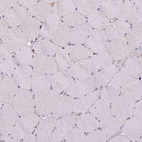 Immunohistochemical staining of human skeletal muscle shows no positivity in myocytes as expected.