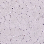 Immunohistochemical staining of human skeletal muscle shows no positivity in myocytes as expected.