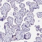 Immunohistochemical staining of human placenta shows no cytoplasmic positivity in trophoblastic cells as expected.