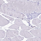 Immunohistochemical staining of human skeletal muscle shows no positivity in myocytes as expected.