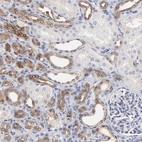 Immunohistochemical staining of human kidney shows moderate cytoplasmic positivity in cells in tubules.
