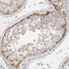 Immunohistochemical staining of human testis shows strong cytoplasmic positivity in spermatogonia.