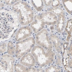 Immunohistochemical staining of human kidney shows moderate cytoplasmic positivity in cells in tubules.