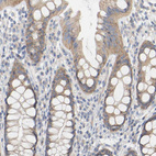 Immunohistochemical staining of human rectum shows moderate cytoplasmic positivity in glandular cells.