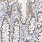 Immunohistochemical staining of human rectum shows moderate cytoplasmic positivity in glandular cells.