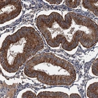 Immunohistochemical staining of human endometrium shows strong cytoplasmic positivity in glandular cells.