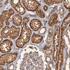 Immunohistochemical staining of human kidney shows strong cytoplasmic positivity in cells in tubules.