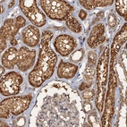Immunohistochemical staining of human kidney shows strong cytoplasmic positivity in cells in tubules.
