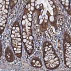 Immunohistochemical staining of human rectum shows strong cytoplasmic positivity in glandular cells.