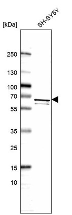 Western blot analysis in human cell line SH-SY5Y.