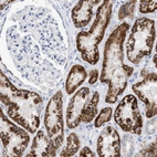 Immunohistochemical staining of human kidney shows strong granular cytoplasmic positivity in cells in tubules.