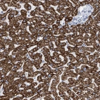 Immunohistochemical staining of human liver shows strong granular cytoplasmic positivity in hepatocytes.