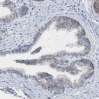 Immunohistochemical staining of human prostate shows moderate granular cytoplasmic positivity in glandular cells.