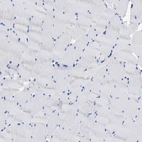 Immunohistochemical staining of human skeletal muscle shows no positivity in myocytes as expected.