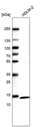 Western blot analysis in human cell line HDLM-2.