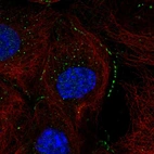 Immunofluorescent staining of human cell line A-431 shows localization to cell junctions.