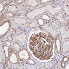 Immunohistochemical staining of human kidney shows strong cytoplasmic/ membranous positivity in cells in glomeruli.