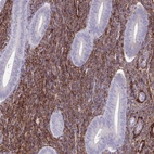 Immunohistochemical staining of human endometrium shows strong membranous positivity in cells in endometrial stroma.