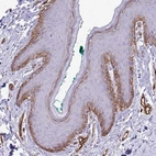 Immunohistochemical staining of human skin shows strong membranous positivity in basal squamous epithelial cells.
