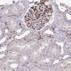 Immunohistochemical staining of human kidney shows strong membranous positivity in cells in glomeruli.