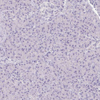 Immunohistochemical staining of human pancreas shows no positivity in exocrine glandular cells as expected.