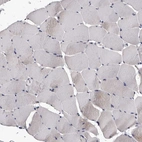 Immunohistochemical staining of human skeletal muscle shows no positivity in myocytes as expected.