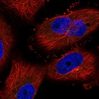 Immunofluorescent staining of human cell line U-251 MG shows localization to centrosome.