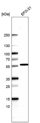 Western blot analysis in human cell line EFO-21.
