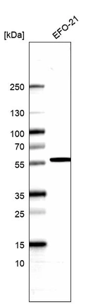 Western blot analysis in human cell line EFO-21.