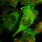 Immunofluorescent staining of human cell line U-251 MG shows localization to plasma membrane & cytosol.