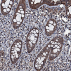 Immunohistochemical staining of human rectum shows strong nuclear-cytoplasmic positivity in lymphoid cells and glandular cells.