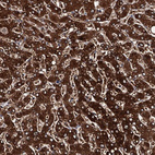 Immunohistochemical staining of human liver shows strong cytoplasmic-nucleus membranous positivity in hepatocytes.