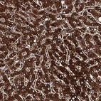 Immunohistochemical staining of human liver shows strong cytoplasmic-nucleus membranous positivity in hepatocytes.