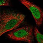 Immunofluorescent staining of human cell line U-2 OS shows localization to nucleoplasm & vesicles.