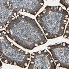 Immunohistochemical staining of human small intestine shows strong cytoplasmic granular positivity glandular cells.