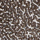 Immunohistochemical staining of human liver shows strong cytoplasmic granular positivity in hepatocytes.