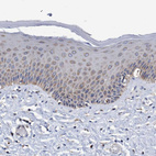 Immunohistochemical staining of human skin shows moderate cytoplasmic granular positivity in squamous epithelial cells.