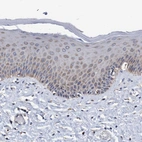 Immunohistochemical staining of human skin shows moderate cytoplasmic granular positivity in squamous epithelial cells.