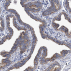 Immunohistochemical staining of human fallopian tube shows strong cytoplasmic granular positivity in glandular cells.
