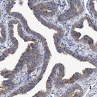 Immunohistochemical staining of human fallopian tube shows strong cytoplasmic granular positivity in glandular cells.