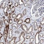 Immunohistochemical staining of human kidney shows strong cytoplasmic granular positivity in cells in tubules.