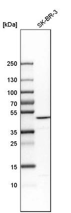 Western blot analysis in human cell line SK-BR-3.
