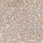 Immunohistochemical staining of human liver shows moderate cytoplasmic positivity in hepatocytes.