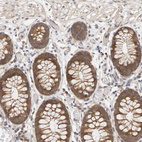 Immunohistochemical staining of human colon shows strong cytoplasmic positivity in glandular cells.