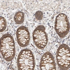 Immunohistochemical staining of human colon shows strong cytoplasmic positivity in glandular cells.