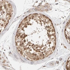 Immunohistochemical staining of human testis shows strong cytoplasmic positivity in cells in seminiferous ducts.